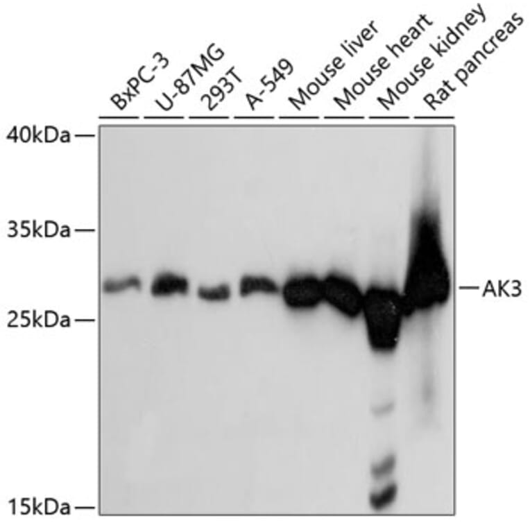 Western Blot - Anti-AK3 Antibody (A88965) - Antibodies.com