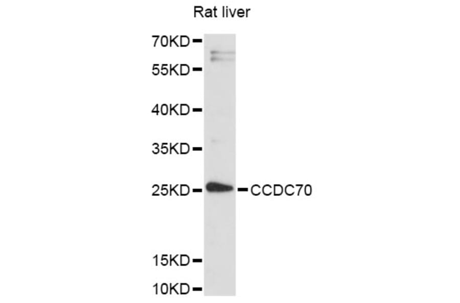Western Blot - Anti-CCDC70 Antibody (A14427) - Antibodies.com