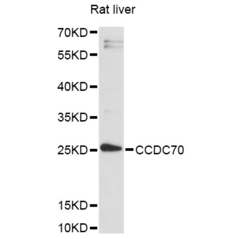 Western Blot - Anti-CCDC70 Antibody (A14427) - Antibodies.com