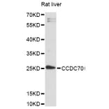 Western Blot - Anti-CCDC70 Antibody (A14427) - Antibodies.com