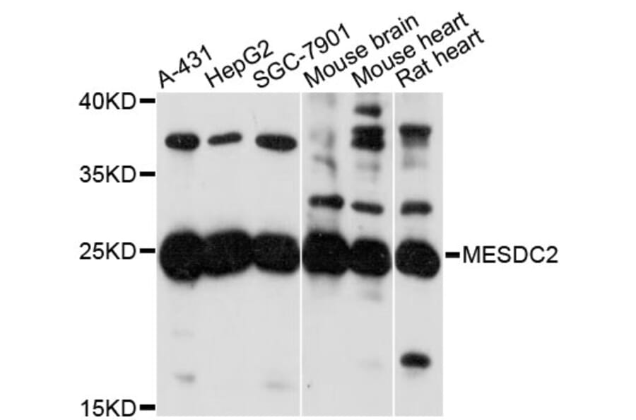 Western Blot - Anti-MESDC2 Antibody (A13932) - Antibodies.com