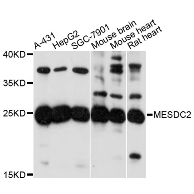 Western Blot - Anti-MESDC2 Antibody (A13932) - Antibodies.com