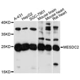 Western Blot - Anti-MESDC2 Antibody (A13932) - Antibodies.com
