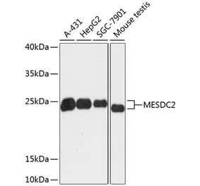 Western Blot - Anti-MESDC2 Antibody (A88968) - Antibodies.com