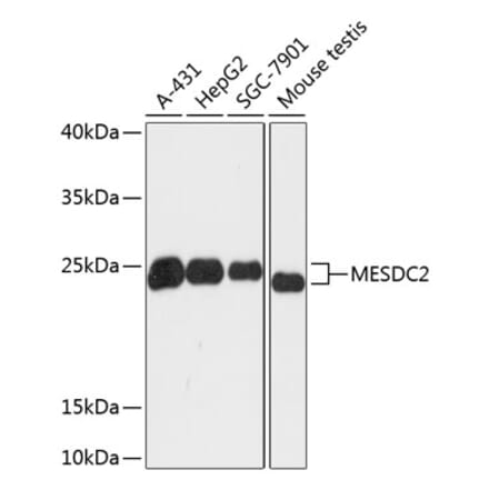 Western Blot - Anti-MESDC2 Antibody (A88968) - Antibodies.com