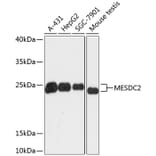 Western Blot - Anti-MESDC2 Antibody (A88968) - Antibodies.com