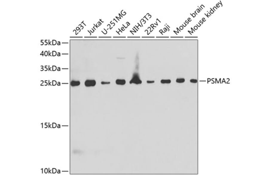 Western Blot - Anti-Proteasome 20S alpha 2/HC3 Antibody (A88969) - Antibodies.com