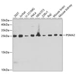 Western Blot - Anti-Proteasome 20S alpha 2/HC3 Antibody (A88969) - Antibodies.com