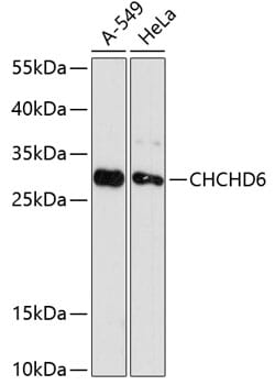 Western blot analysis of extracts of various cell lines, using Anti-CHCHD6 Antibody (A12911) at 1:3000 dilution.
Secondary antibody: Goat Anti-Rabbit IgG (H+L) (HRP) (AS014) at 1:10,000 dilution.
Lysates / proteins: 25µg per lane.
Blocking buffer: 3% non-fat dry milk in TBST.
Detection: ECL Basic Kit (RM00020).
Exposure time: 90s.