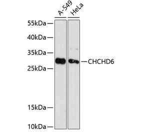 Western Blot - Anti-CHCHD6 Antibody (A88970) - Antibodies.com