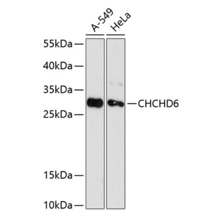 Western Blot - Anti-CHCHD6 Antibody (A88970) - Antibodies.com