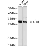 Western Blot - Anti-CHCHD6 Antibody (A88970) - Antibodies.com