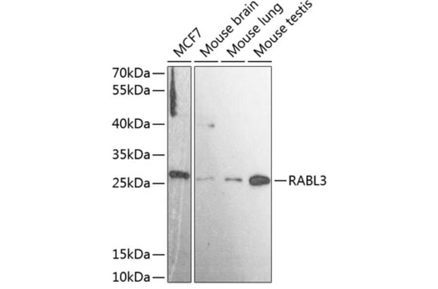 Western Blot - Anti-RABL3 Antibody (A88971) - Antibodies.com