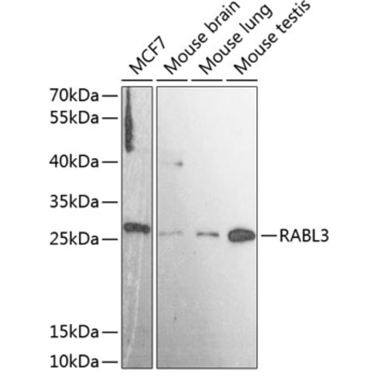 Western Blot - Anti-RABL3 Antibody (A88971) - Antibodies.com