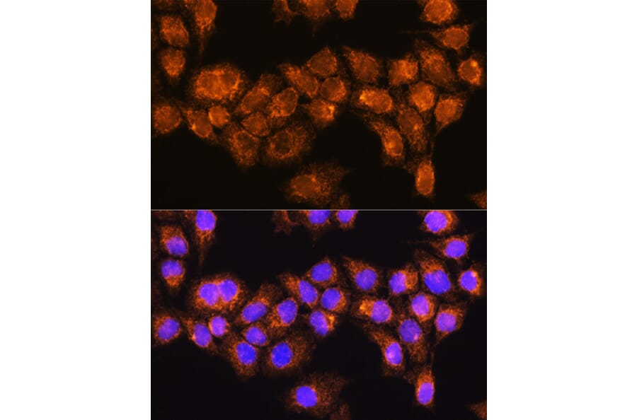 Immunofluorescence - Anti-RABL3 Antibody (A88971) - Antibodies.com