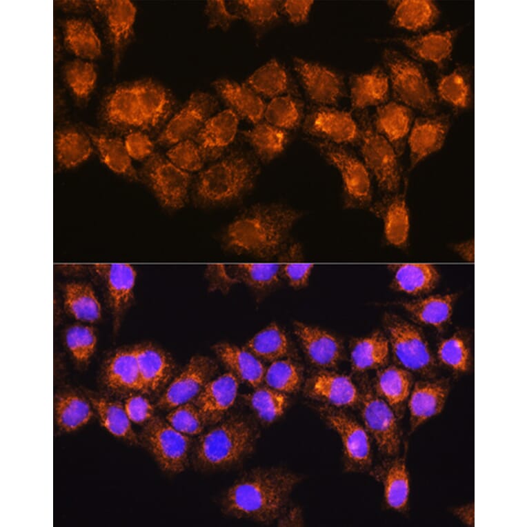 Immunofluorescence - Anti-RABL3 Antibody (A88971) - Antibodies.com
