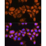 Immunofluorescence - Anti-RABL3 Antibody (A88971) - Antibodies.com
