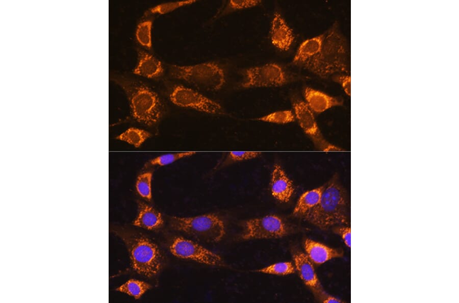 Immunofluorescence - Anti-RABL3 Antibody (A88971) - Antibodies.com