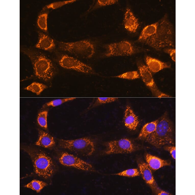 Immunofluorescence - Anti-RABL3 Antibody (A88971) - Antibodies.com