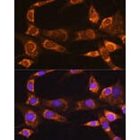 Immunofluorescence - Anti-RABL3 Antibody (A88971) - Antibodies.com