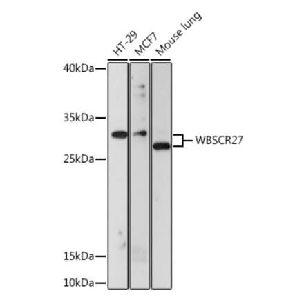 Western Blot - Anti-METTL27 Antibody (A88972) - Antibodies.com