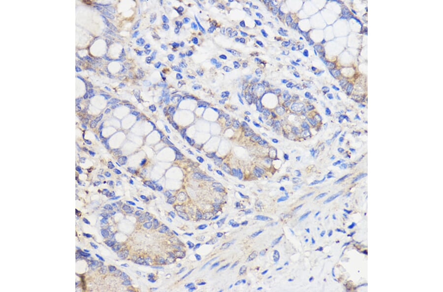 Immunohistochemistry - Anti-METTL27 Antibody (A88972) - Antibodies.com