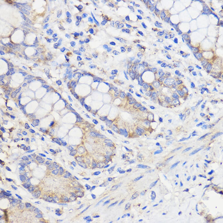 Immunohistochemistry - Anti-METTL27 Antibody (A88972) - Antibodies.com