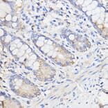 Immunohistochemistry - Anti-METTL27 Antibody (A88972) - Antibodies.com