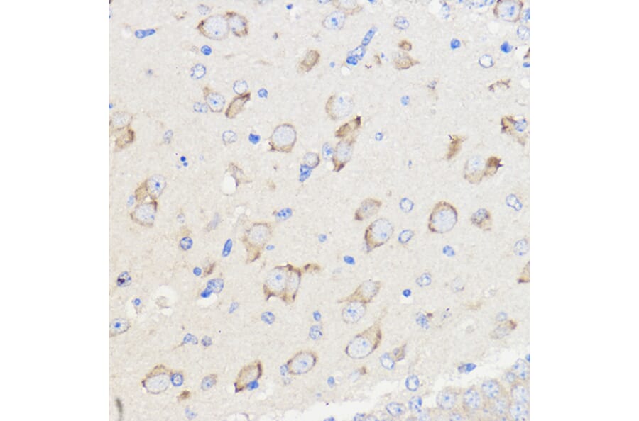 Immunohistochemistry - Anti-METTL27 Antibody (A88972) - Antibodies.com