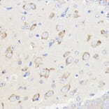 Immunohistochemistry - Anti-METTL27 Antibody (A88972) - Antibodies.com