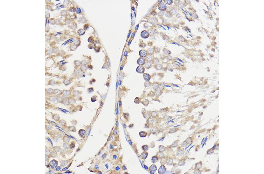 Immunohistochemistry - Anti-METTL27 Antibody (A88972) - Antibodies.com