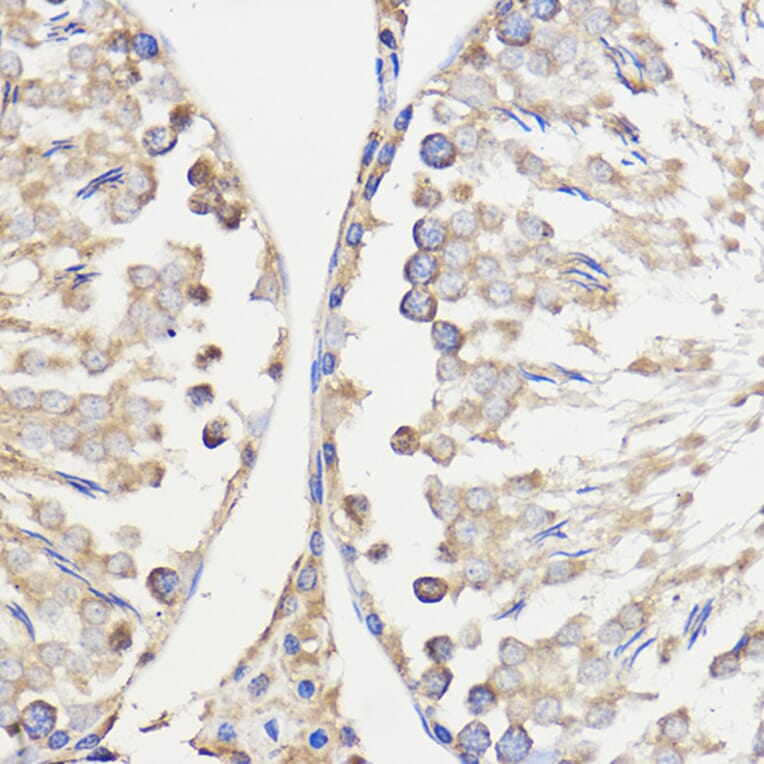 Immunohistochemistry - Anti-METTL27 Antibody (A88972) - Antibodies.com