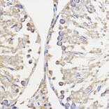 Immunohistochemistry - Anti-METTL27 Antibody (A88972) - Antibodies.com