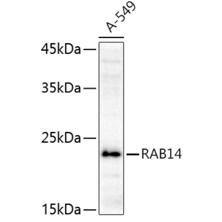 Western Blot - Anti-RAB14 Antibody (A88973) - Antibodies.com
