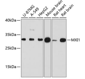 Western Blot - Anti-MXI1 Antibody (A88974) - Antibodies.com