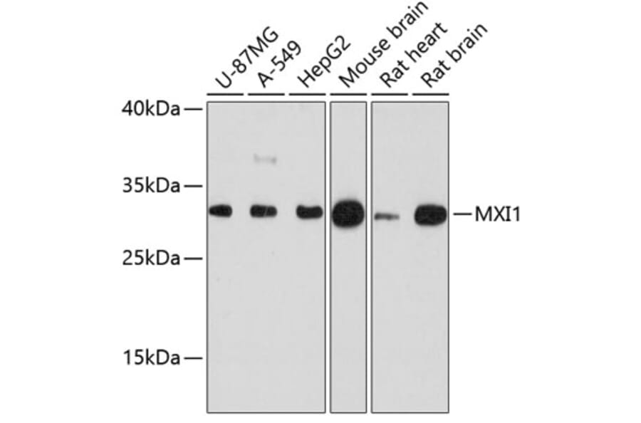 Western Blot - Anti-MXI1 Antibody (A88974) - Antibodies.com