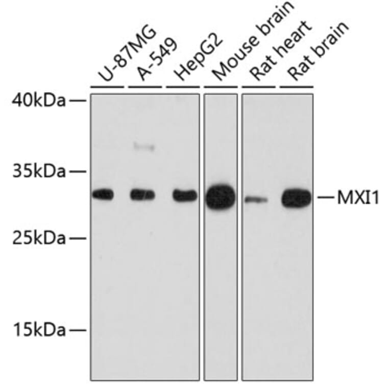 Western Blot - Anti-MXI1 Antibody (A88974) - Antibodies.com