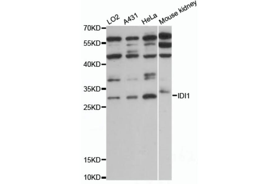 Western Blot - Anti-IDI1 Antibody (A13826) - Antibodies.com