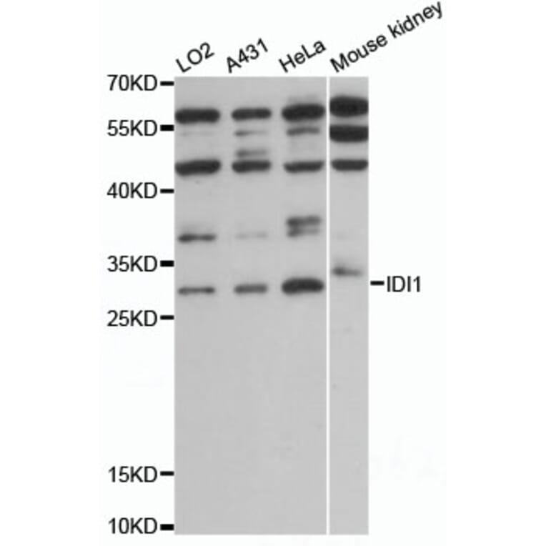 Western Blot - Anti-IDI1 Antibody (A13826) - Antibodies.com