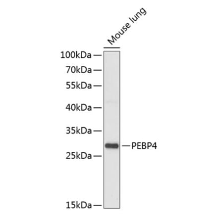Western Blot - Anti-PEBP4 Antibody (A88976) - Antibodies.com