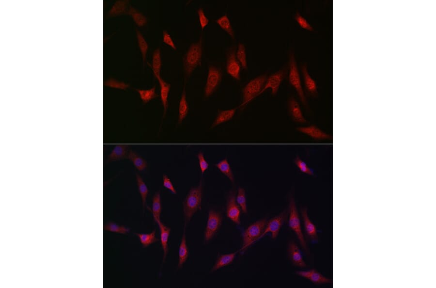 Immunofluorescence - Anti-MSRA Antibody (A88977) - Antibodies.com