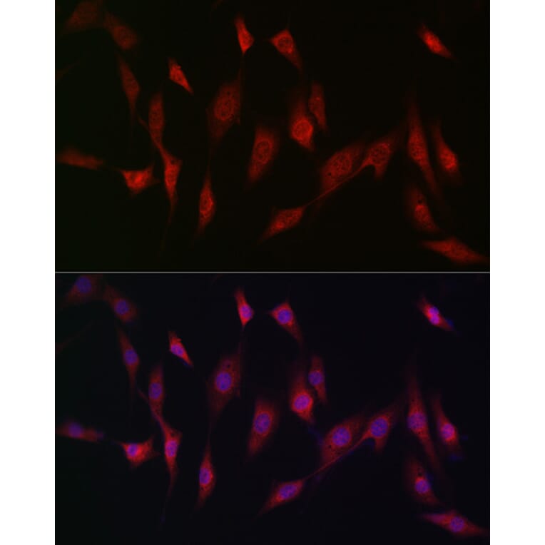 Immunofluorescence - Anti-MSRA Antibody (A88977) - Antibodies.com