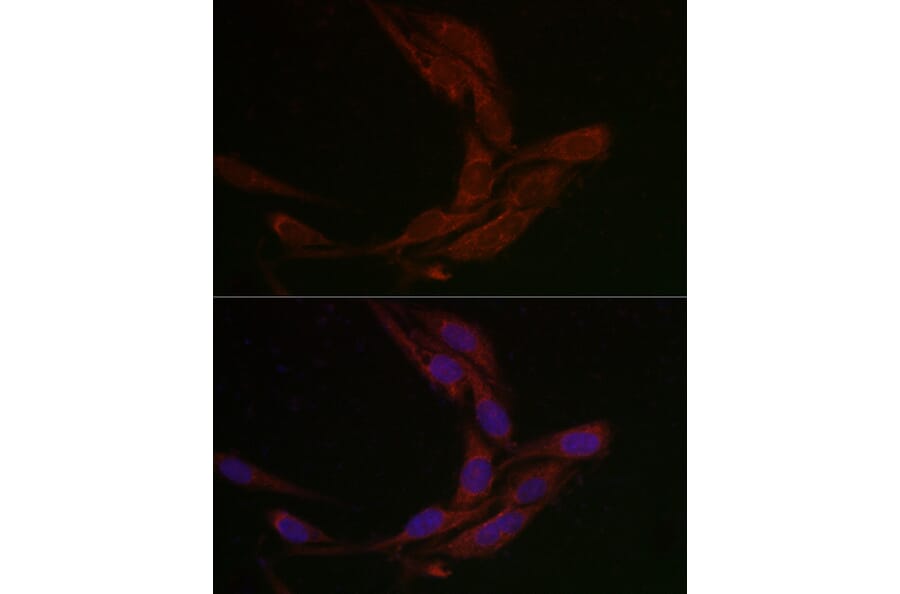 Immunofluorescence - Anti-MSRA Antibody (A88977) - Antibodies.com