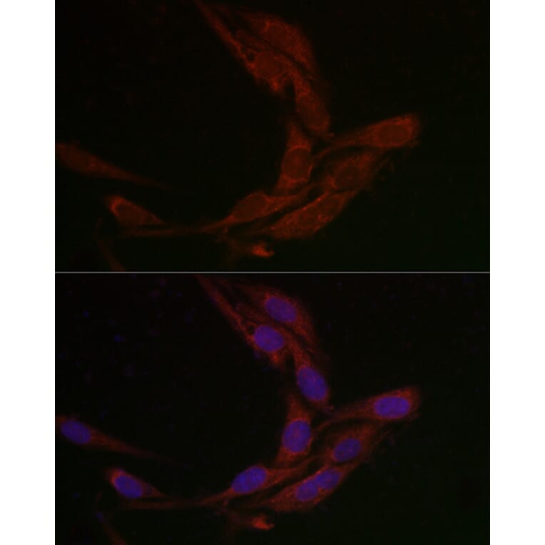 Immunofluorescence - Anti-MSRA Antibody (A88977) - Antibodies.com