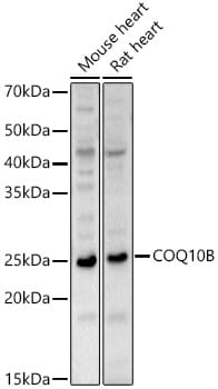 Western blot analysis of extracts of various cell lines, using Anti-COQ10B Antibody (A15193) at 1:1,000 dilution.
Secondary antibody: Goat Anti-Rabbit IgG (H+L) (HRP) (AS014) at 1:10,000 dilution.
Lysates / proteins: 25µg per lane.
Blocking buffer: 3% non-fat dry milk in TBST.
Detection: ECL Basic Kit (RM00020).
Exposure time: 30s.