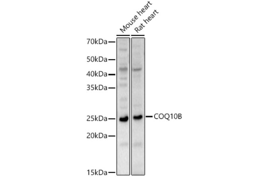 Western Blot - Anti-COQ10B Antibody (A88978) - Antibodies.com
