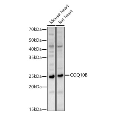 Western Blot - Anti-COQ10B Antibody (A88978) - Antibodies.com