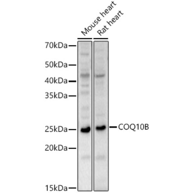 Western Blot - Anti-COQ10B Antibody (A88978) - Antibodies.com