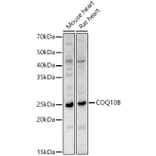 Western Blot - Anti-COQ10B Antibody (A88978) - Antibodies.com