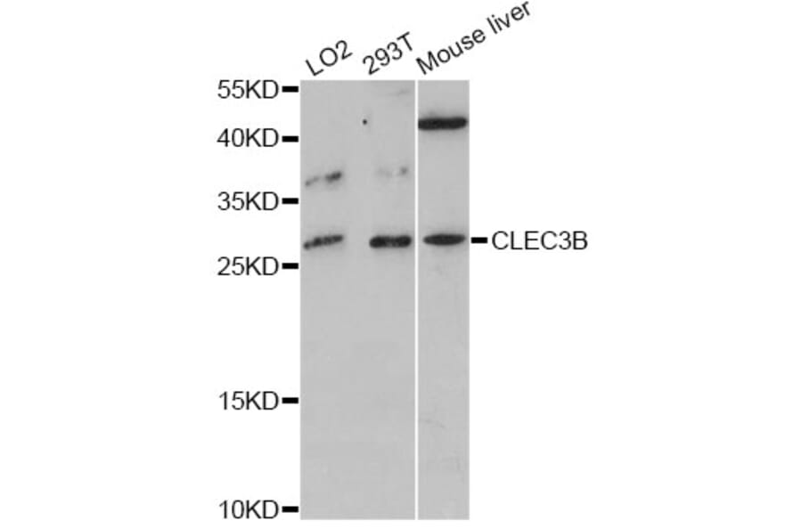 Western Blot - Anti-CLEC3B Antibody (A12358) - Antibodies.com